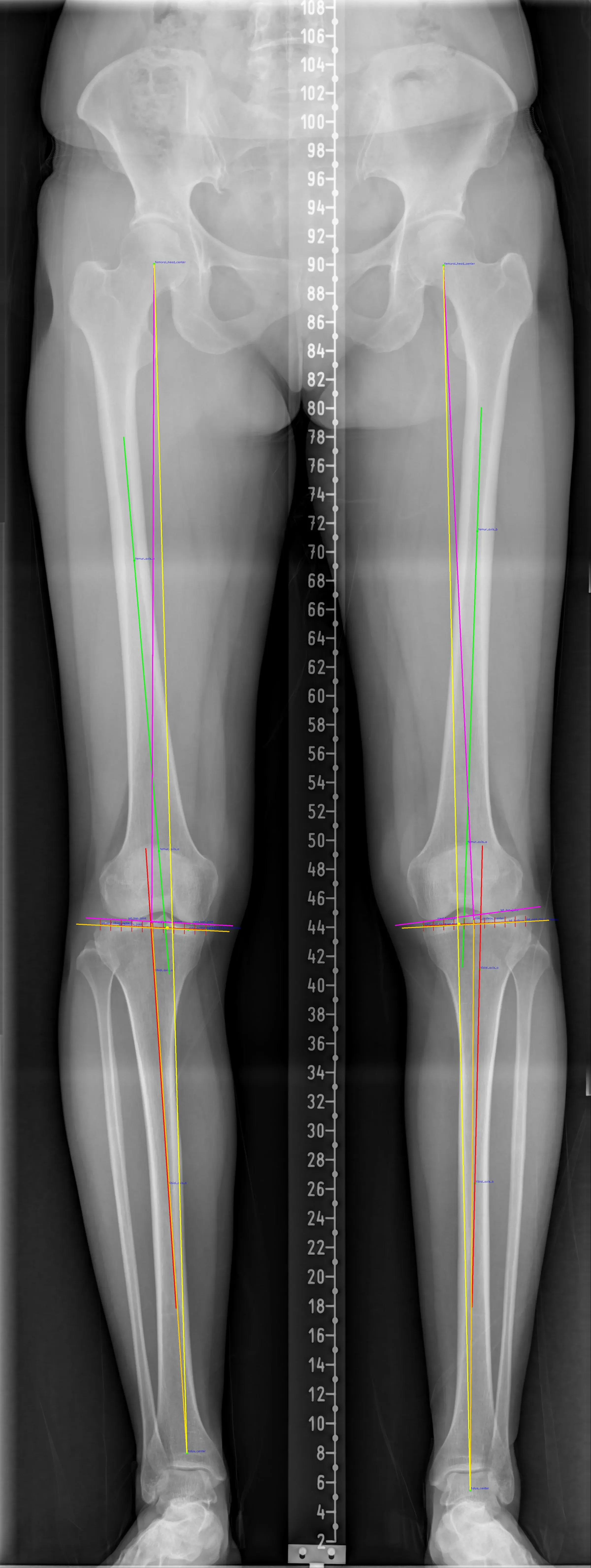 Full Scanogram analysis